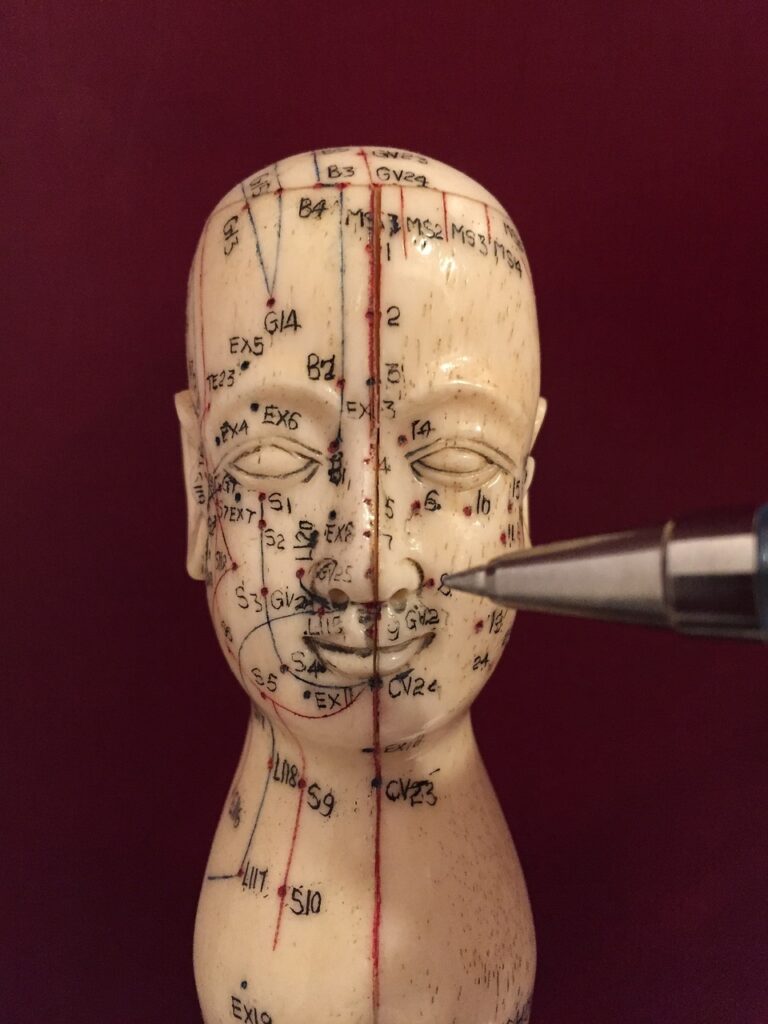 acupuncture, acupuncture points, acupuncturist, medicine, stimulation, body, alternative, points, healing, acupuncture, acupuncture, acupuncture, acupuncture, acupuncture