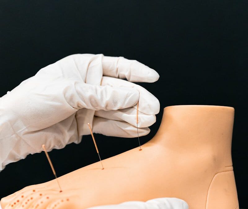 Step Into Wellness: Acupuncture for Foot Health